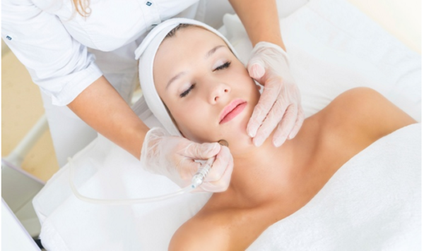 Microdermabrasion